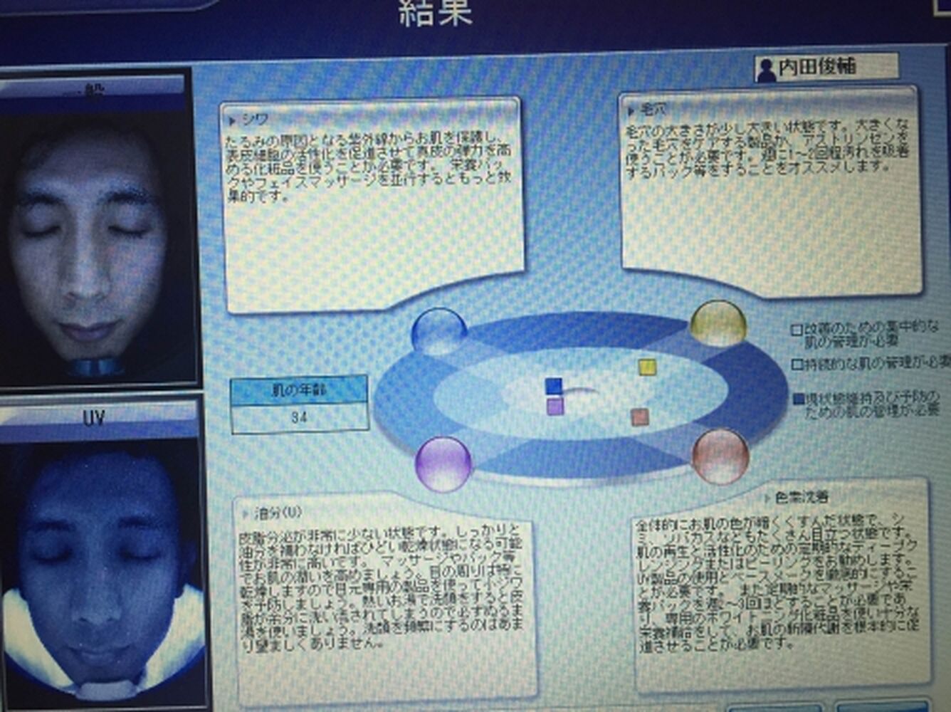 ブログ