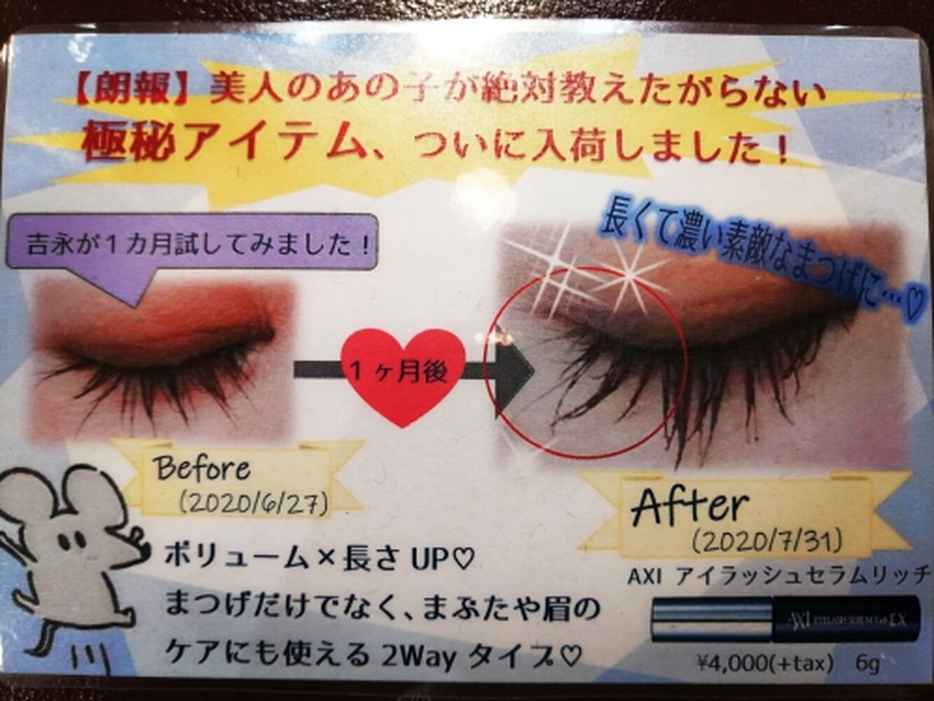 ブログ