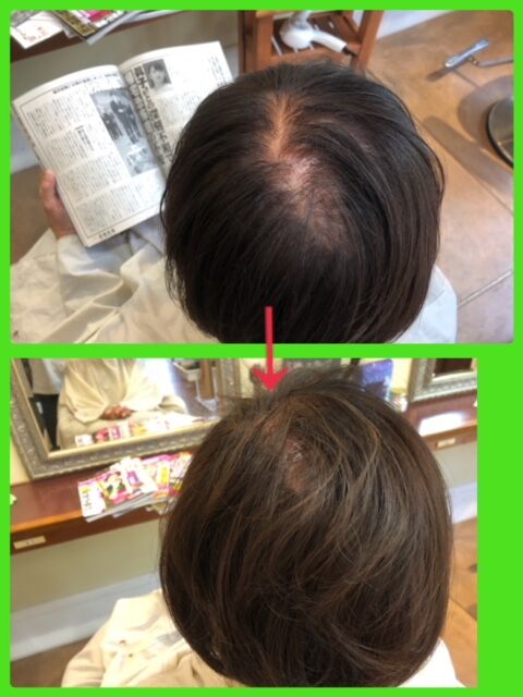 ヘアループ